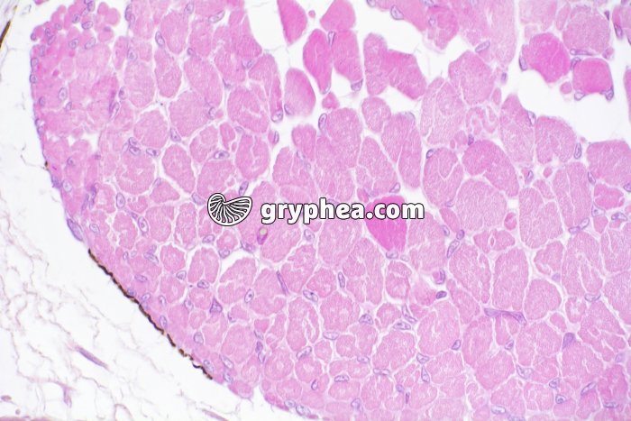 Tétard muscles en CT x100 - gryphea.com